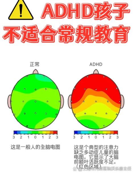 孩子延迟满足能力如何影响未来人生？-图1